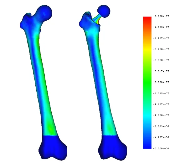 Cadaveric study results