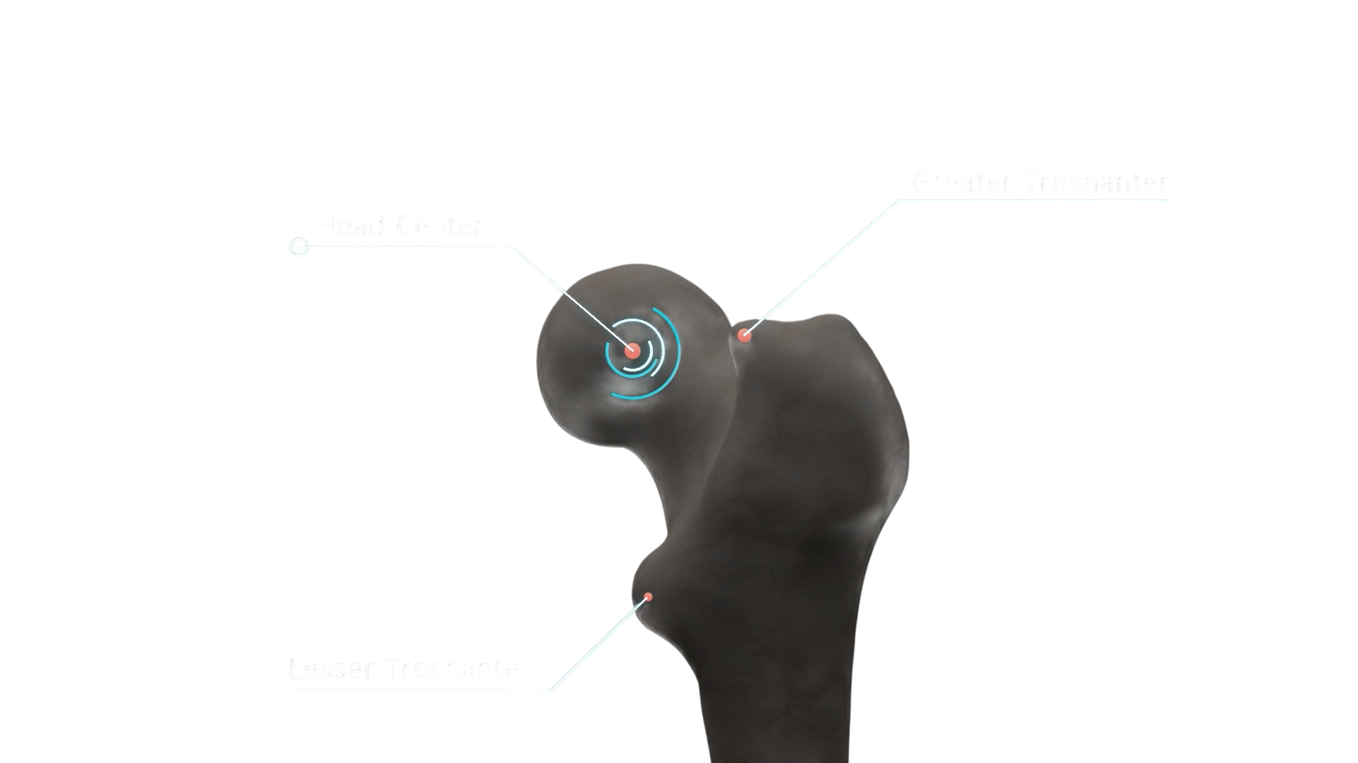 Arthroniq Femur AI
